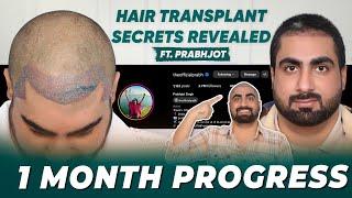 Hair Transplant in India | Best Results & Cost of Hair Transplant in India