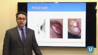 Scar and Keloid Management | Andrew Vardanian, MD | UCLAMDChat