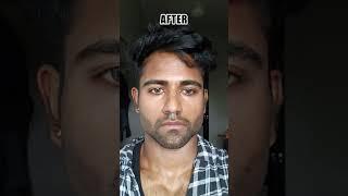 Good Indian Looksmaxxing Transformation (blackpill) #blackpill #lookmaxxing #mewing