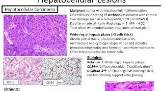 Liver Tumors: Kurt's Notes #pathagonia