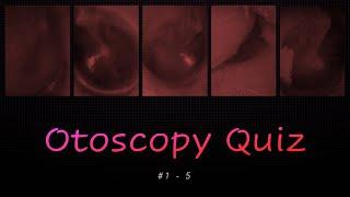 Otoscopy Quiz #1 - 5