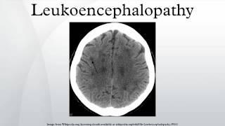 Leukoencephalopathy