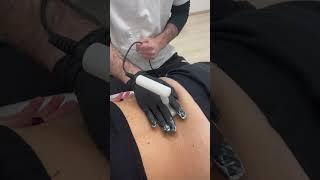 TECAR TERAPIA MM SPINALI VIDEO