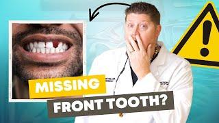 The 5 Best Options to REPLACE Your Missing Front Tooth (Dental Implants, Bridges & More)