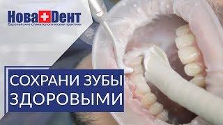  В чем эффективность профессиональной гигиены полости рта. Профессиональная гигиена полости рта.12+