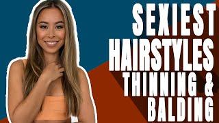 Sexiest Hairstyles For Men With Thinning Hair/Balding Hair | Mens Fashioner | Ashley Weston