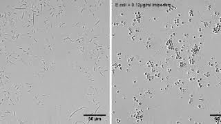 E. coli forms spheroplasts upon Imipenem treatment - β-lactam-induced cell burst