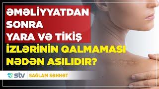 ƏMƏLİYYATDAN SONRA YARA VƏ TİKİŞ İZLƏRİNİN QALMAMASI NƏDƏN ASILIDIR? - SAĞLAM SƏHHƏT (28.08.2024)