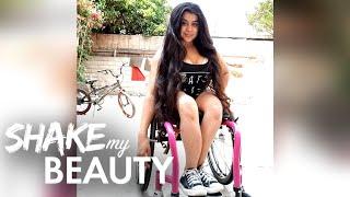 I'm 26 And I've Broken 400 Bones | SHAKE MY BEAUTY