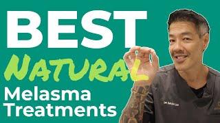 Natural Treatments for Melasma | Dr Davin Lim
