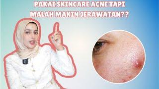 UDAH PAKAI SKINCARE ACNE KOK MALAH TAMBAH JERAWAT?? | Simak dulu penjelasan nya!