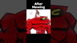 Mewing Transformation