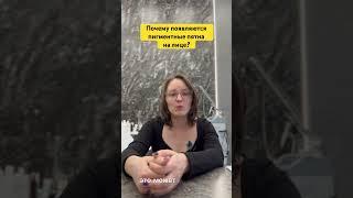 Почему появляются пигментные пятна на лице? #косметолог #косметология #уход #пигментныепятна