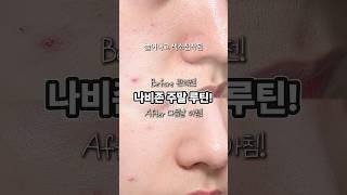 올리브영 추천템! 나비존 모공축소 주말 루틴 리들샷 700으로 7년 젊어지기  #skincare #모공수축