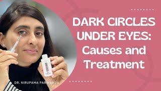 Dark circles under eyes | What causes dark circles Under Eyes?| Dark circle under eye cream