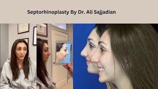 Septorhinoplasty by Dr. Ali Sajjadian | Narrowing Nasal Bones and lowering the Nasal Bridge!