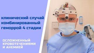 Клинический случай: комбинированный геморрой 4 стадии, осложненный кровотечениями и анемией