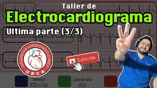 Taller de Electrocardiograma By URCA última parte (3/3)