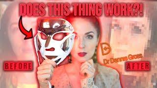 Dr. Dennis Gross Spectralite Faceware Pro LED Mask HONEST REVIEW After 5 Months!