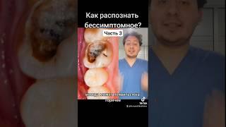 Пульпит без симптомов? - Ч.3 #стоматолог #стоматология #протезированиезубов #зубы #баку #азербайджан