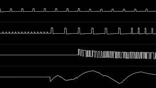 VinylCheese - "Ottifanten Der Zoo" (NES) [Oscilloscope View]