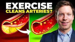 This Exercise Clears Plaque in Your Arteries! New Trial