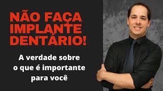 VOCÊ NÃO PRECISA FAZER IMPLANTE DENTÁRIO! ENTENDA O QUE REALMENTE É IMPORTANTE PARA SUA SAÚDE.