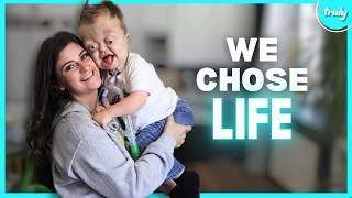 Our 3-Year-Old Has Had 30 Surgeries - He's No 'Monster' | BORN DIFFERENT