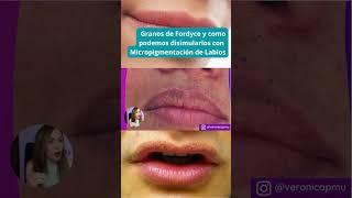 Granos de Fordyce y como podemos disimularlos con Micropigmentación de Labios 