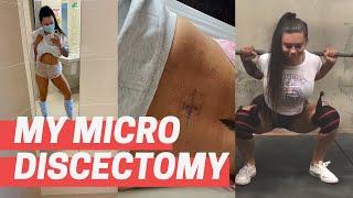 My Microdiscectomy