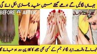 Hands And  Foot Whitening DIY | Homemade Manicure Pedicure | Skin Whitening Facial At Home