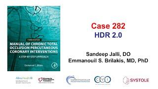 Case 281: Manual of CTO PCI - HDR 2.0