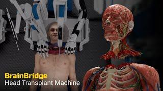 Head Transplant Machine – BrainBridge