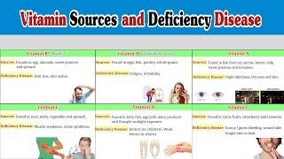 Vitamin Sources and Deficiency Disease | Vitamin deficiency Disease #vitamin