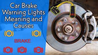 Car Brake Warning Lights Meaning and Causes | The Car Doctor Pakistan
