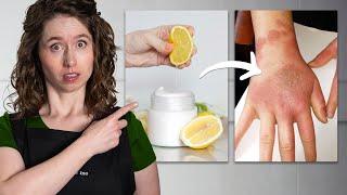 5 DANGEROUS DIY Skincare Mistakes Beginners Make ️