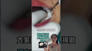 做假牙費用和房價一樣回不去了#顯微根管#全瓷冠