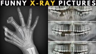 Weird Funny and Interesting X-Ray Results (Part 2)