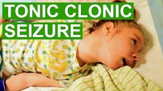 Tonic Clonic Seizure Video