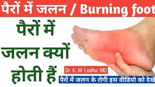 #Pero me jalan kyo hoti hai#पैरों के तलवों में जलन क्यों होती हैं #Burning feet sensation #DrKMLodha