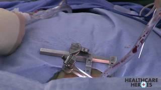 Spine Surgery