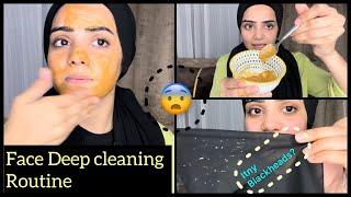 This Is How I Remove My Blackheads On Face  |  Live Results |Dietitian Aqsa