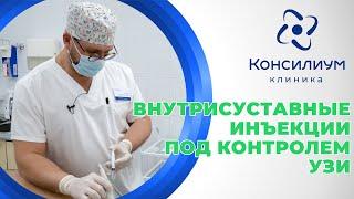 Внутрисуставные инъекции под контролем УЗИ