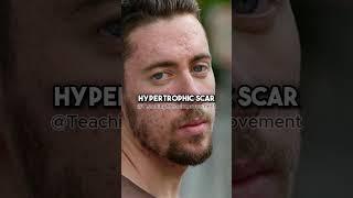 Jose Zuniga (TeachingMensFashion) reveals mens style tip to REMOVE ACNE FAST
