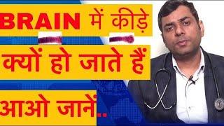 दिमागी कीड़ा कैसे बनता है ? सिर में कीड़े के लक्षण | Neurocysticercosis treatment in hindi