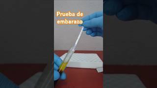 ¿Cómo se realiza una prueba de EMBARAZO en sangre? #shorts #embarazo #testdeembarazo