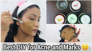 Best DIY kit for All Skin problems | DIY for Acne and Scars |