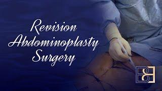 Revision Abdominoplasty Surgery [ 2020 ]