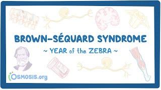 Brown-Séquard syndrome (Year of the Zebra)