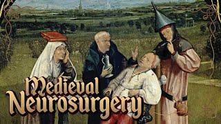 Middle Ages Surgery: History of Neurosurgery